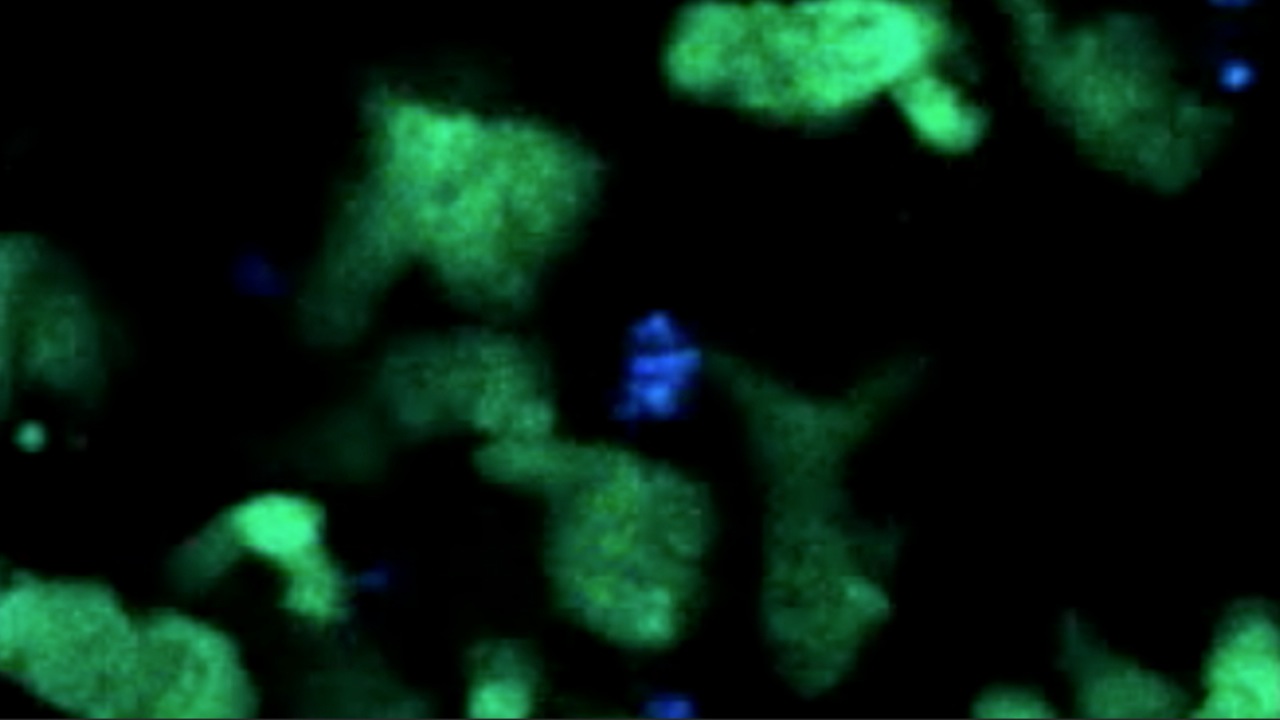 Video: Video-Still: Staphylococcus aureus-Bakterien im Mikroskop